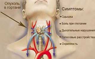 Можно ли курить, если болит горло